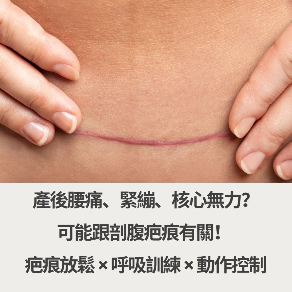 剖腹產疤痕